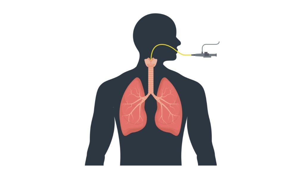 Airway Management - ACLS Study Guide