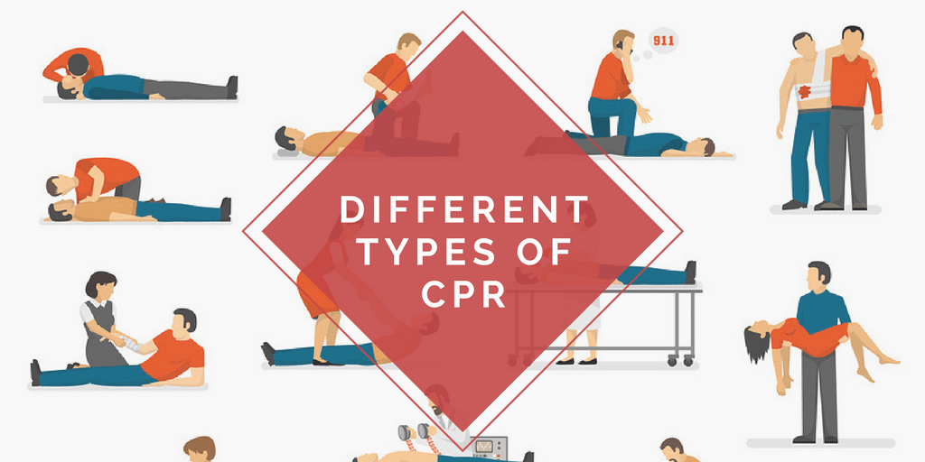 Different Types of CPR