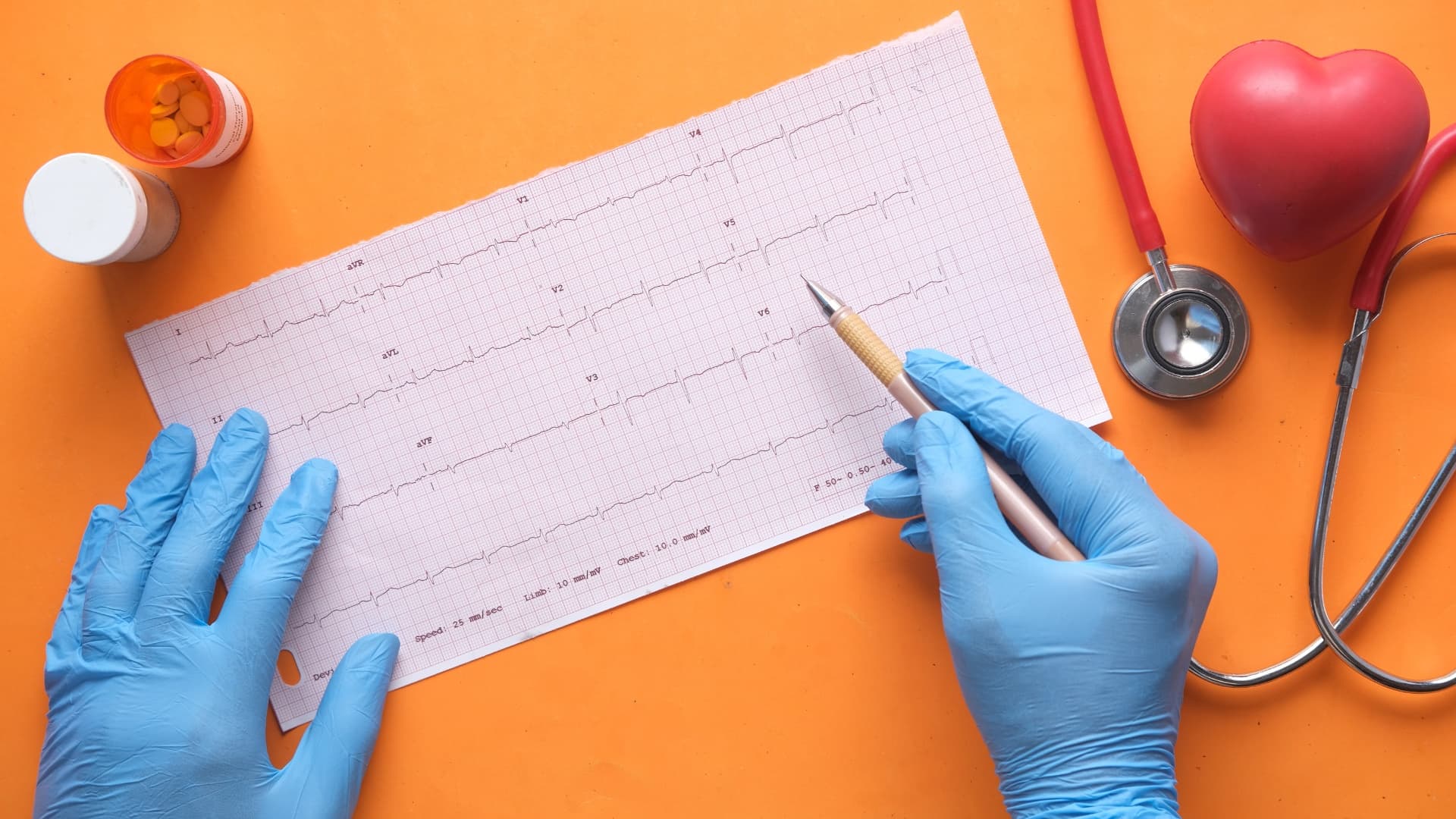 decoding-ecg-understand-vtach-vs-vfib-easily-surefire-cpr