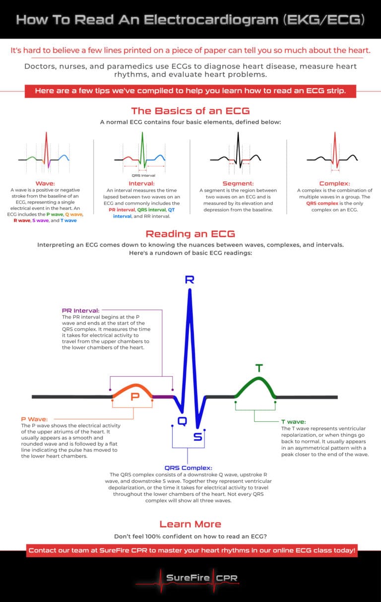 EKG/ECG Cheat Sheet, ECG, EKG, how to read an ECG, ECG interpretation, understanding ECG, heart health, ECG waves, PR interval, QRS complex, T wave, P wave, cardiac health