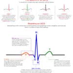 How To Read An EKG