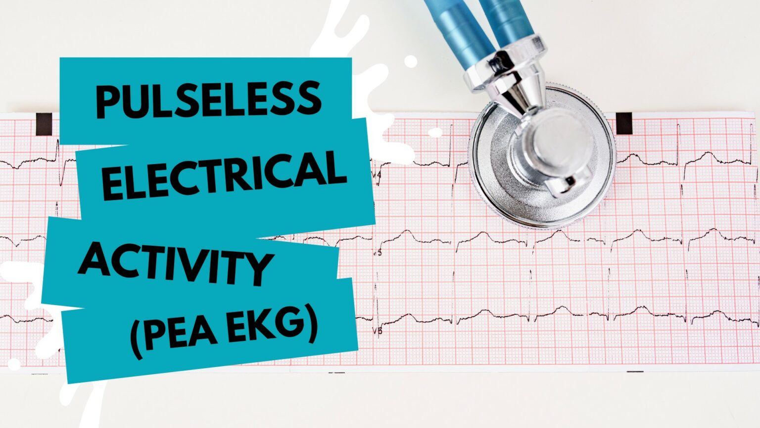 Life on the Line_ PEA and Its EKG Triggers Hero Image