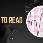 How to read EKG