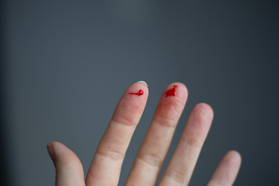 Blood loss from capillary bleeding from fingers